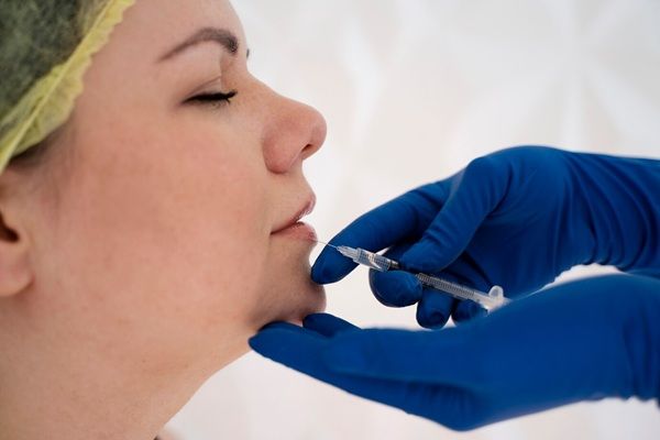 Istituto Dermoclinico Vita Cutis Donna di vista laterale che riceve l'iniezione cliniche filler labbra Roma