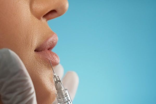Clinica Villa Stuart Iniezione cosmetica di botox nelle labbra