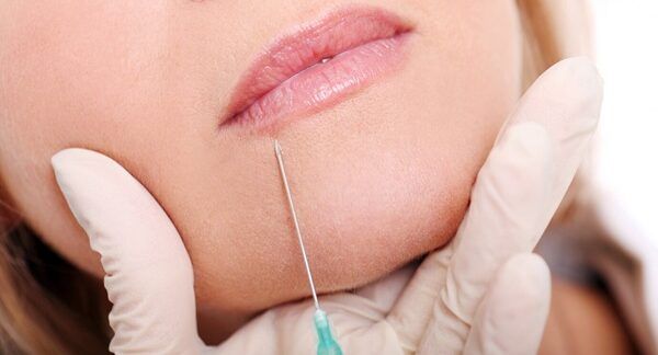 Le 10 migliori cliniche di filler labbra a Roma Primo piano delle mani del cosmetologo che fa l'iniezione di botox sulle labbra femminili.