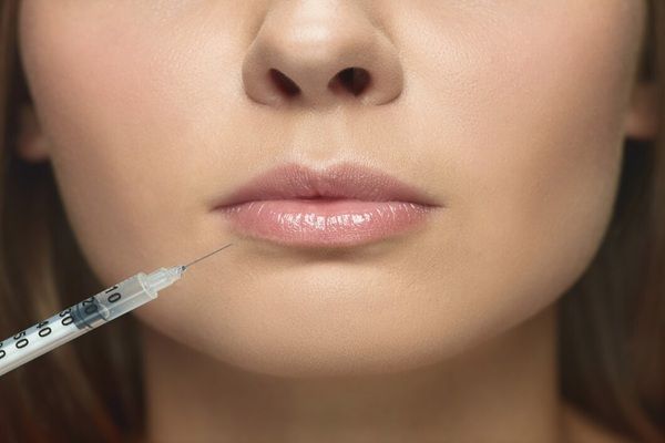 GVM Cura & Ricerca - Ospedale San Carlo di Nancy Ritratto del primo piano di giovane donna sulla parete bianca. Procedura di chirurgia di riempimento. Aumento delle labbra.