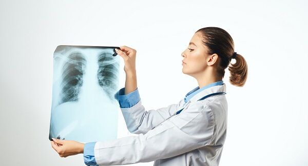 I 10 migliori pneumologi a Roma